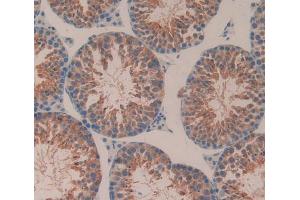 IHC-P analysis of Mouse Testis Tissue, with DAB staining. (CD51 抗体  (AA 71-322))