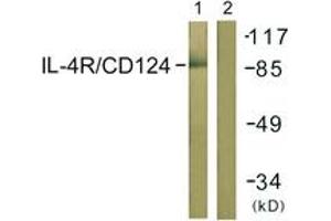 Western blot analysis of extracts from 293 cells, using IL-4R/CD124 (Ab-497) Antibody. (IL4 Receptor 抗体  (AA 463-512))