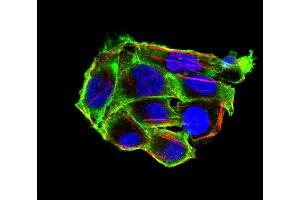 Immunofluorescence analysis of Hela cells using VIL1 mouse mAb (green). (Villin 1 抗体  (AA 1-209))