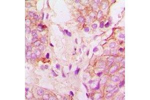 Immunohistochemistry (IHC) image for anti-Cytochrome P450, Family 51, Subfamily A, Polypeptide 1 (CYP51A1) antibody (ABIN7307716)