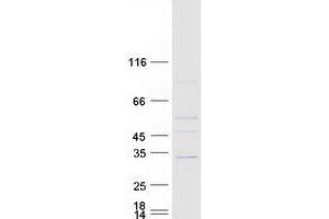 Western Blotting (WB) image for Ankyrin Repeat and SOCS Box Containing 7 (ASB7) (Transcript Variant 1) protein (Myc-DYKDDDDK Tag) (ABIN2714970)