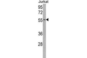 Western Blotting (WB) image for anti-Ubiquitin Specific Peptidase 22 (USP22) antibody (ABIN3001480) (USP22 抗体)