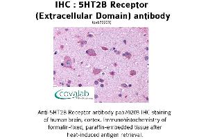 Image no. 1 for anti-Serotonin Receptor 2B (HTR2B) (2nd Extracellular Domain) antibody (ABIN1731363) (Serotonin Receptor 2B 抗体  (2nd Extracellular Domain))