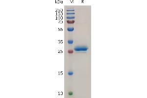 Human Mesothelin(37-286) Protein, His Tag on SDS-PAGE under reducing condition.
