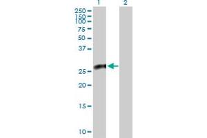 Western Blot analysis of CACYBP expression in transfected 293T cell line by CACYBP MaxPab polyclonal antibody. (CACYBP 抗体  (AA 1-228))