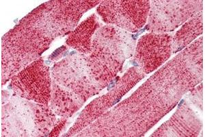 Immunohistochemistry (IHC) image for anti-Solute Carrier Family 5 (Iodide Transporter), Member 6 (SLC5A6) (Internal Region) antibody (ABIN1049346)
