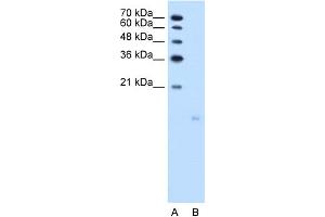 WB Suggested Anti-PPFIBP1 Antibody Titration:  2. (PPFIBP1 抗体  (N-Term))