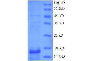 SDS-PAGE (SDS) image for Connective Tissue Growth Factor (CTGF) (AA 253-349), (partial) protein (GST tag) (ABIN1046858)