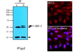Immunofluorescence of human HeLa cells stained with IRF-3 (1:500) with Texas-Red and Hoechst 33342 (Blue) for nucleus staining. (IRF3 抗体  (AA 108-166))