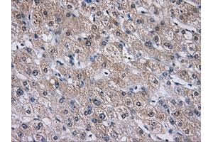 Immunohistochemical staining of paraffin-embedded liver tissue using anti-AKR1A1mouse monoclonal antibody. (AKR1A1 抗体)