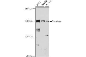 Western blot analysis of extracts of various cell lines, using Timeless antibody (ABIN1682797, ABIN7101315, ABIN7101316 and ABIN7101317) at 1:1000 dilution. (TIMELESS 抗体)