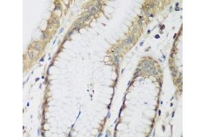 Immunohistochemistry of paraffin-embedded Human stomach using METTL7A Polyclonal Antibody at dilution of 1:200 (40x lens). (METTL7A 抗体)
