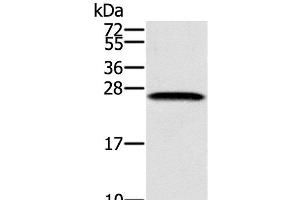 Western Blot analysis of K562 cell using SSX1 Polyclonal Antibody at dilution of 1:400 (SSX1 抗体)