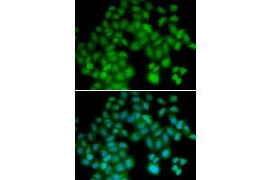 Immunofluorescence (IF) image for anti-Thymosin beta-4 (TMSB4X) antibody (ABIN1876626) (TMSB4X 抗体)