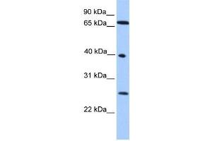 Human HeLa; WB Suggested Anti-L3MBTL2 Antibody Titration: 0. (L3MBTL2 抗体  (N-Term))