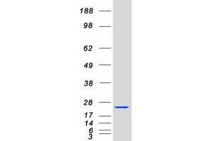 Western Blotting (WB) image for Acireductone Dioxygenase 1 (ADI1) protein (Myc-DYKDDDDK Tag) (ABIN2714410)