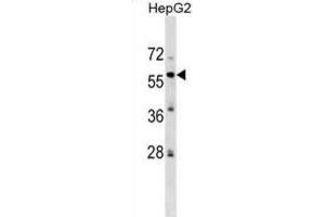 Western Blotting (WB) image for anti-Zinc finger protein 82 homolog (ZFP82) antibody (ABIN2999761) (Zinc finger protein 82 homolog (ZFP82) 抗体)