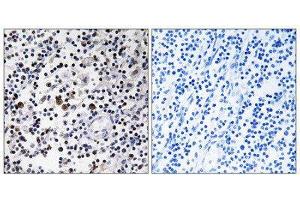 Immunohistochemistry (IHC) image for anti-CD302 (CD302) (Internal Region) antibody (ABIN1850248) (DCL1 抗体  (Internal Region))