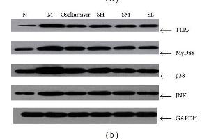 Mice were anesthetized and then infected intranasally by dropping 0. (TLR7 抗体  (AA 461-560))
