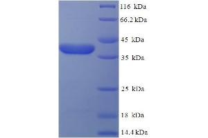 SDS-PAGE (SDS) image for Estrogen Receptor Binding Site Associated, Antigen, 9 (EBAG9) (AA 28-213), (Cytoplasmic Domain), (Cytosolic) protein (His-SUMO Tag) (ABIN5709431) (RCAS1 Protein (AA 28-213, Cytoplasmic Domain, Cytosolic) (His-SUMO Tag))