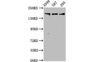 Western Blot Positive WB detected in: A549 whole cell lysate, U87 whole cell lysate, 293 whole cell lysate All lanes: AGRN antibody at 7. (AGRN 抗体  (AA 968-1130))