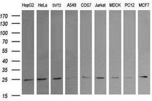 Image no. 2 for anti-RAB21, Member RAS Oncogene Family (RAB21) antibody (ABIN1500548) (RAB21 抗体)
