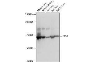 Western blot analysis of extracts of various cell lines, using CES1 Rabbit mAb (ABIN7266077) at 1:1000 dilution. (CES1 抗体)