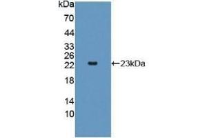 Detection of Recombinant AK2, Rat using Polyclonal Antibody to Adenylate Kinase 2 (AK2) (Adenylate Kinase 2 抗体  (AA 64-232))