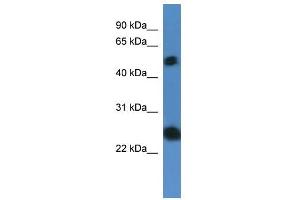 Western Blot showing SLA2 antibody used at a concentration of 1-2 ug/ml to detect its target protein. (SLAP2 抗体  (N-Term))