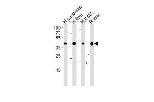 Western blot analysis of lysates from human pancreas, liver, testis and rat liver tissue lysate (from left to right), using HMGCS2 Antibody (C-term) (ABIN390764 and ABIN2841022). (HMGCS2 抗体  (C-Term))