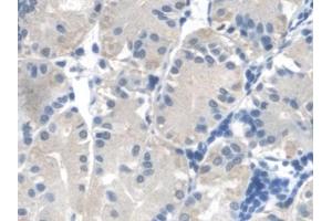 Immunohistochemistry (IHC) image for anti-Fumarate Hydratase (FH) (AA 45-188) antibody (ABIN7444424)