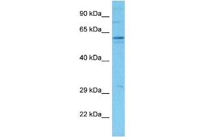 Host:  Rabbit  Target Name:  SLCO2B1  Sample Tissue:  Human Hela Whole Cell  Antibody Dilution:  1ug/ml (SLCO2B1 抗体  (N-Term))