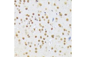 Immunohistochemistry (IHC) image for anti-APOBEC1 Complementation Factor (A1CF) (AA 50-120) antibody (ABIN6136302)