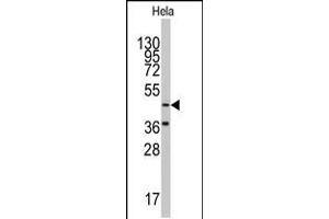 Western blot analysis of anti-NARS2 Antibody in Hela cell line lysates (35ug/lane).