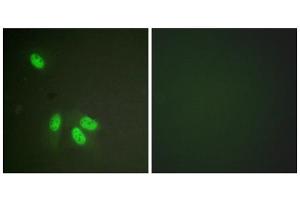 Immunofluorescence analysis of HeLa cells, using hnRPD (epitope around residue 83) antibody.