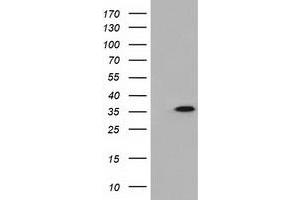 Western Blotting (WB) image for anti-Deoxynucleotidyltransferase, Terminal, Interacting Protein 1 (DNTTIP1) antibody (ABIN1497877) (DNTTIP1 抗体)