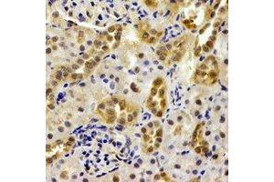 Immunohistochemistry (IHC) image for anti-Proteasome (Prosome, Macropain) Subunit, beta Type, 9 (Large Multifunctional Peptidase 2) (PSMB9) antibody (ABIN7306016)