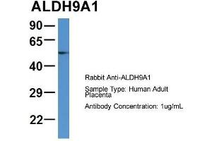 Host: Rabbit  Target Name: ALDH9A1  Sample Tissue: Human Adult Placenta  Antibody Dilution: 1. (ALDH9A1 抗体  (C-Term))