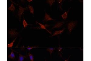 Immunofluorescence analysis of C6 cells using GPER1 Polyclonal Antibody at dilution of 1:100. (Mesothelin 抗体)