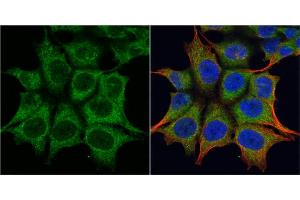 Immunofluorescence (IF) image for anti-Tripartite Motif Containing 23 (TRIM23) (N-Term) antibody (ABIN2857044)
