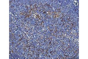 IHC analysis of Il2ra using anti-Il2ra antibody (ABIN7600684).