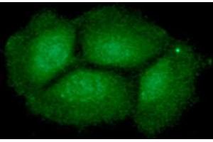 ICC/IF analysis of ING2 in Hep3B cells line, stained with DAPI (Blue) for nucleus staining and monoclonal anti-human ING2 antibody (1:100) with goat anti-mouse IgG-Alexa fluor 488 conjugate (Green). (ING2 抗体  (AA 1-280))