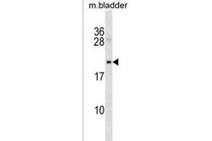 Rat Mycb Antibody (C-term) (ABIN1536682 and ABIN2850194) western blot analysis in mouse bladder tissue lysates (35 μg/lane). (Protein B-Myc 抗体  (C-Term))