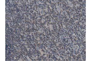 Immunohistochemical staining of paraffin-embedded Human lymph node tissue using anti-DNAJA2 mouse monoclonal antibody. (DNAJA2 抗体)
