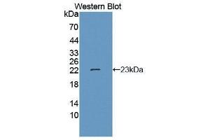 Western Blotting (WB) image for anti-N-Acetylgalactosaminidase, alpha (NAGA) (AA 218-411) antibody (ABIN1859954) (NAGA 抗体  (AA 218-411))
