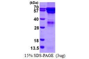 Image no. 1 for Regulator of G-Protein Signaling 14 (RGS14) (AA 1-566) protein (His tag) (ABIN6386992)