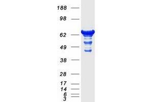 Western Blotting (WB) image for Septin 9 (SEPT9) (Transcript Variant 3) protein (Myc-DYKDDDDK Tag) (ABIN2731698)