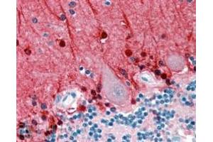 ABIN185628 (2. (Amphiphysin 抗体  (Internal Region))