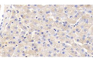 Detection of IL5 in Canine Liver Tissue using Polyclonal Antibody to Interleukin 5 (IL5) (IL-5 抗体  (AA 20-134))