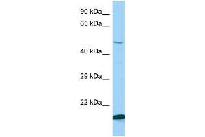 Host: Rabbit Target Name: Kbtbd2 Sample Type: Mouse Testis lysates Antibody Dilution: 1. (KBTBD2 抗体  (N-Term))